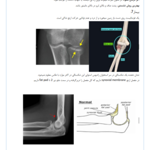 آناتومی بالینی اندام فوقانی-ebbee.ir